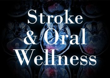 Bellevue dentists, Dr. Mack & Dr. Wachter of Family Dentistry of Bellevue explain the connection between oral wellness and stroke, and how you can increase your protection.