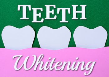 Bellevue dentists, Dr. Mack & Dr. Wachter of Family Dentistry of Bellevue, share everything you need to know about different types of teeth whitening.